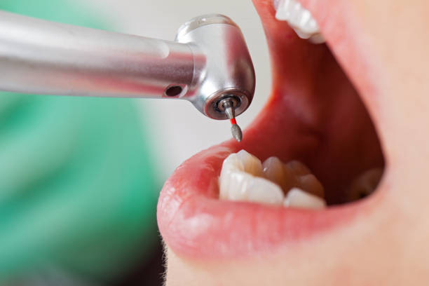 Best Emergency Broken Tooth Repair in Sewalls Point, FL